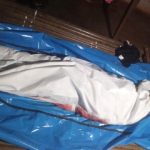 Disparition D’Organes Au Centre Hospitalier De Yaoundé Disparition D'Organes Au Centre Hospitalier De Yaoundé