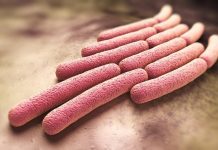 Shigella Reports Another Death Amid Government Denial Shigella Reports Another Death Amid Government Denial