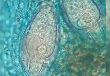 New Schistosomiasis Outbreak Confirmed in São Miguel New Schistosomiasis Outbreak Confirmed in São Miguel