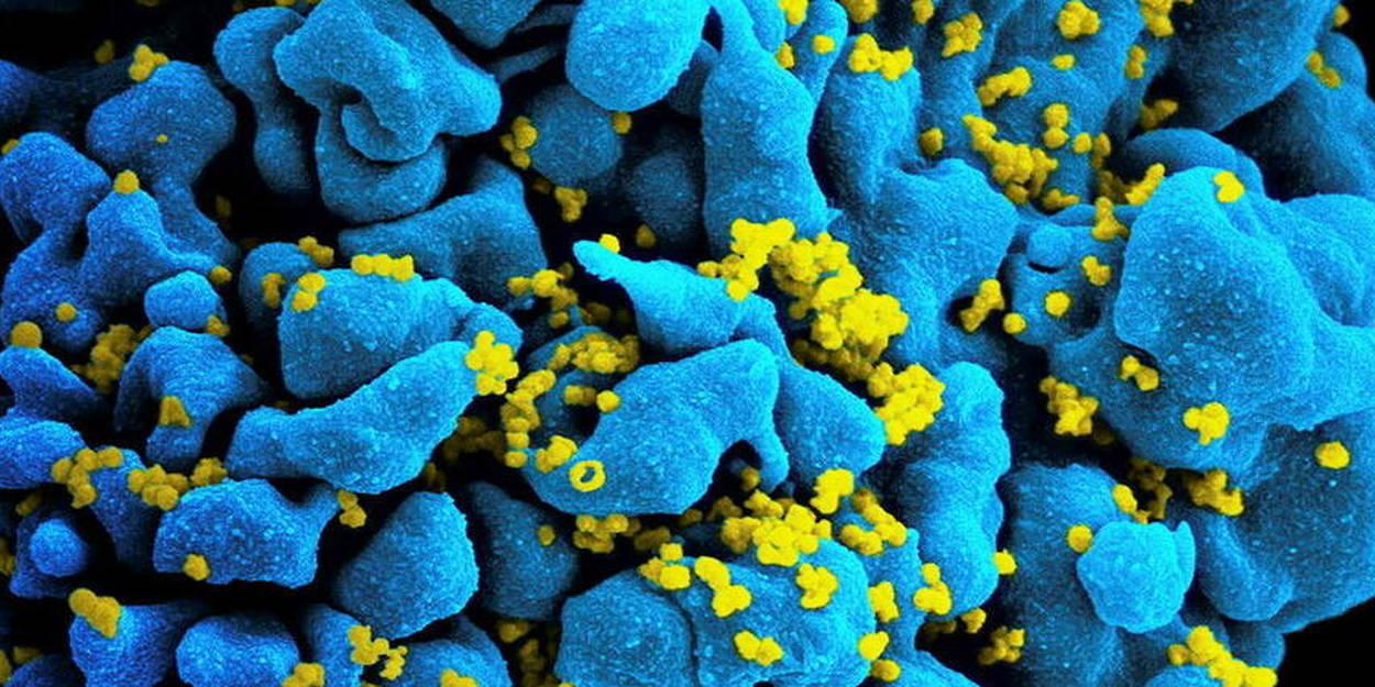 Sida : une troisième patiente guérie grâce à un nouveau traitement Sida : une troisième patiente guérie grâce à un nouveau traitement