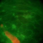 Organoïdes Cardiaques pour Fibrillation Auriculaire Organoïdes Cardiaques pour Fibrillation Auriculaire