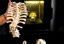 Impression 3D Pour Une Médecine De Précision Impression 3D Pour Une Médecine De Précision