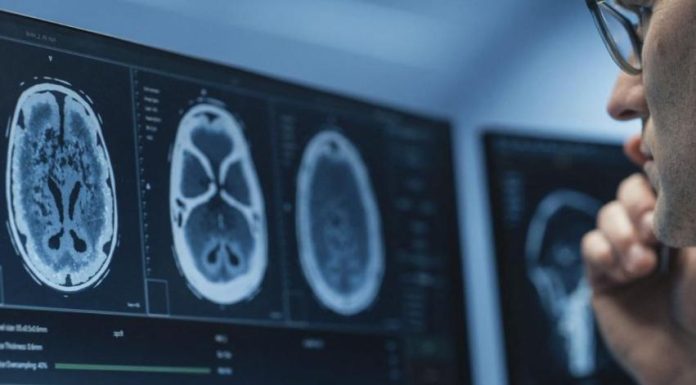 IRM Cérébrale: IA Améliore Détection des Anomalies IRM Cérébrale: IA Améliore Détection des Anomalies