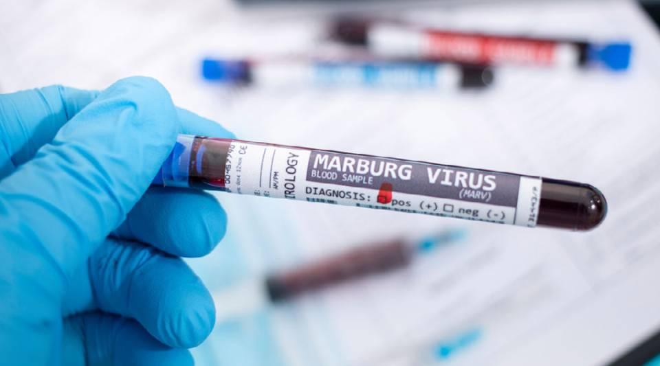 Virus Marburg en Tanzanie : Le pays suit de près la situation