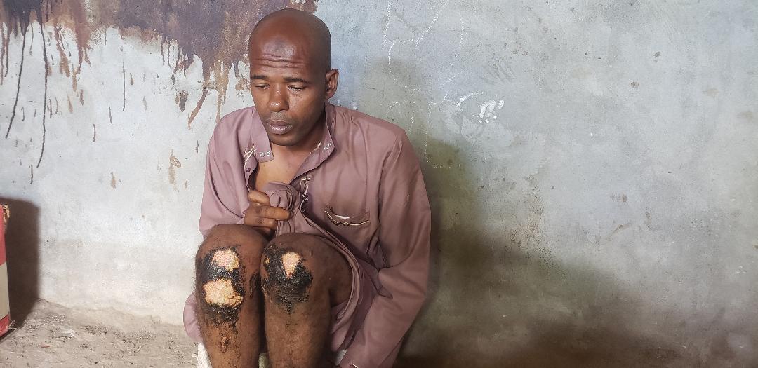 Barthez torturé par des militaires de la garde côte de Mohéli Barthez torturé par des militaires de la garde côte de Mohéli