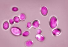 Champignon Multirésistant Alerte les Hôpitaux Européens Champignon Multirésistant Alerte les Hôpitaux Européens