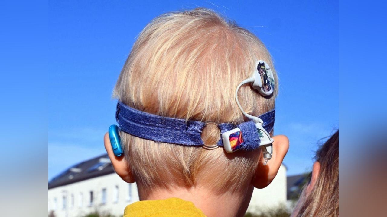 Surdité: L’Implant Cochléaire, une Solution « Miracle »? Surdité: L’Implant Cochléaire, une Solution « Miracle »?