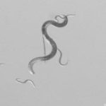 Qu’Est-Ce que le Nématode du Pin, qui Envahit les Landes? Qu’Est-Ce que le Nématode du Pin, qui Envahit les Landes?