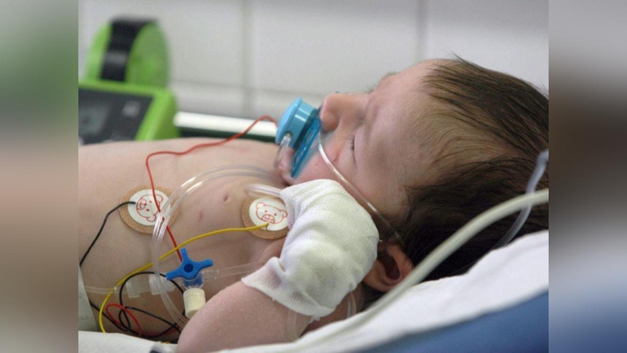 Bronchiolite: Transfert de Bébés D’Ile-De-France Bronchiolite: Transfert de Bébés D’Ile-De-France