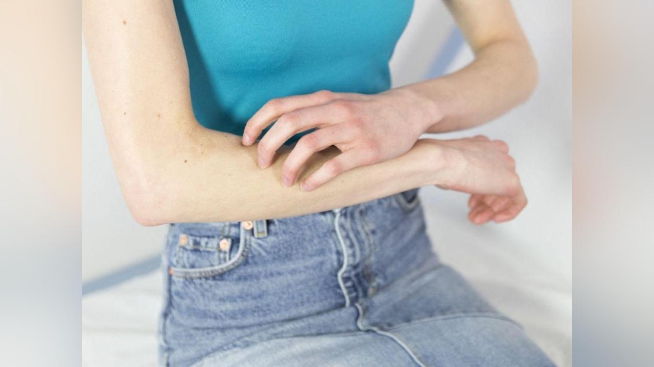 Les Démangeaisons Sont-Elles une Forme de Douleur? Les Démangeaisons Sont-Elles une Forme de Douleur?