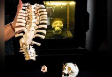 HôPital: L’Impression 3D pour une Médecine de Précision HôPital: L’Impression 3D pour une Médecine de Précision