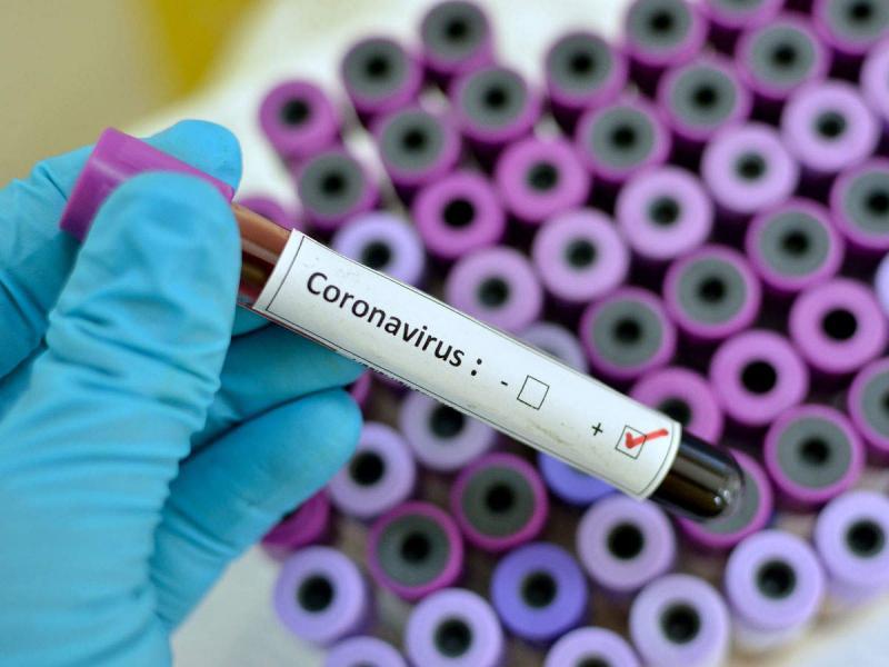 Covid-19 : 276 nouveaux cas testés positifs vendredi en RDC Covid-19 : 276 nouveaux cas testés positifs vendredi en RDC