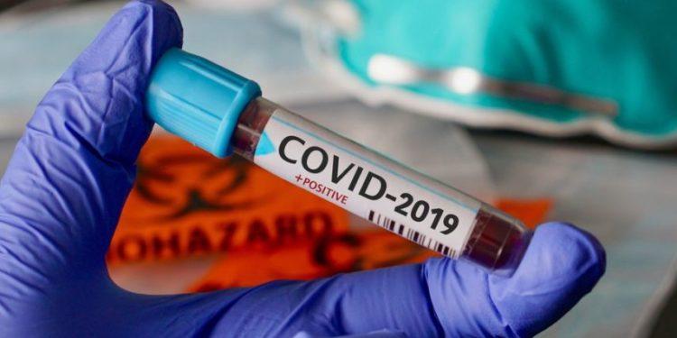 Covid-19 en RDC: 90 nouveaux cas confirmés dans 4 provinces Covid-19 en RDC: 90 nouveaux cas confirmés dans 4 provinces