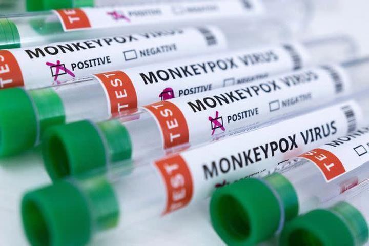 Variole de singe : l’OMS a dénombré 780 cas de variole de singe dans 27 pays non endémique Variole de singe : l’OMS a dénombré 780 cas de variole de singe dans 27 pays non endémique