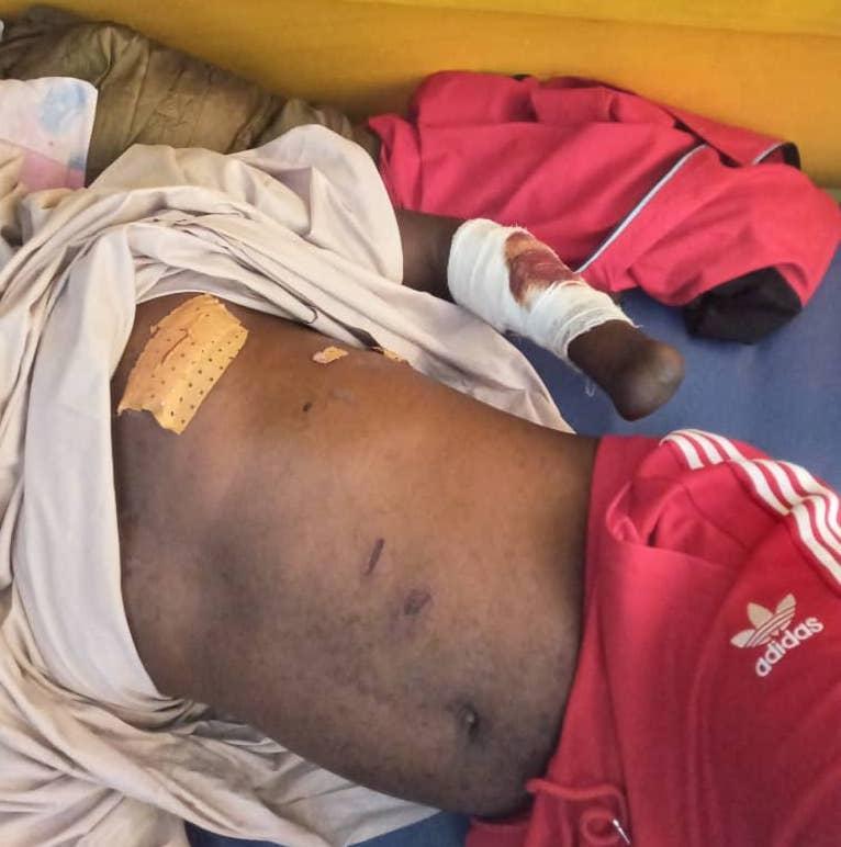 Route Labé-Tougué : le principal du collège de Koïn blessé par balle, alors qu’il venait de prendre son salaire à Labé