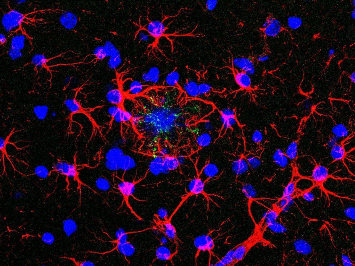 Des souris résistent à la maladie d’Alzheimer grâce à une mutation humaine Des souris résistent à la maladie d’Alzheimer grâce à une mutation humaine