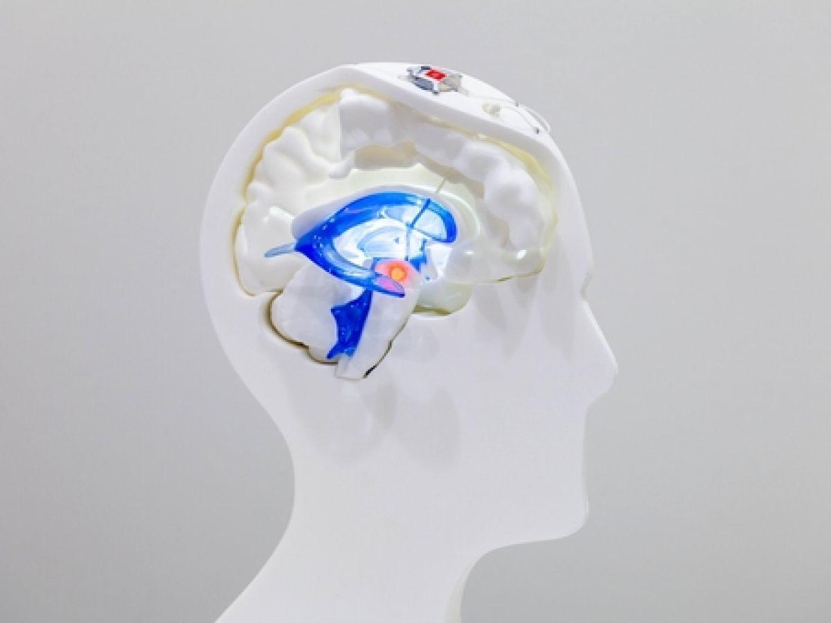 Lumière sur la maladie de Parkinson : un dispositif implanté dans la tête du patient ! Lumière sur la maladie de Parkinson : un dispositif implanté dans la tête du patient !
