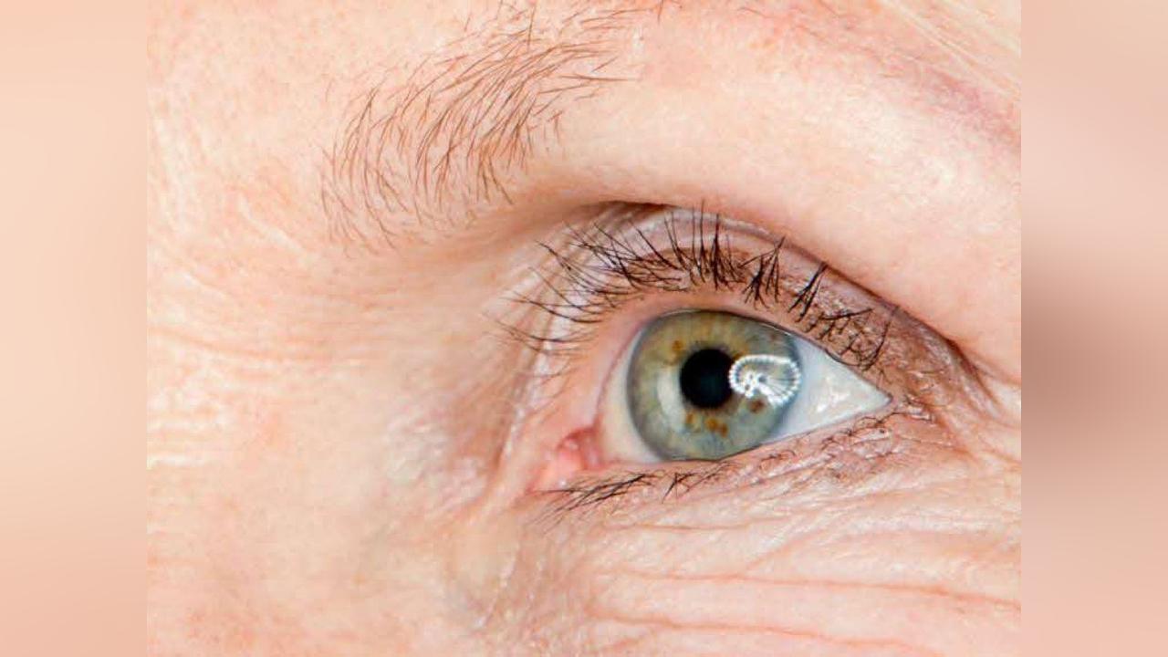Maladies des Yeux : des Vitamines Protectrices Maladies des Yeux : des Vitamines Protectrices