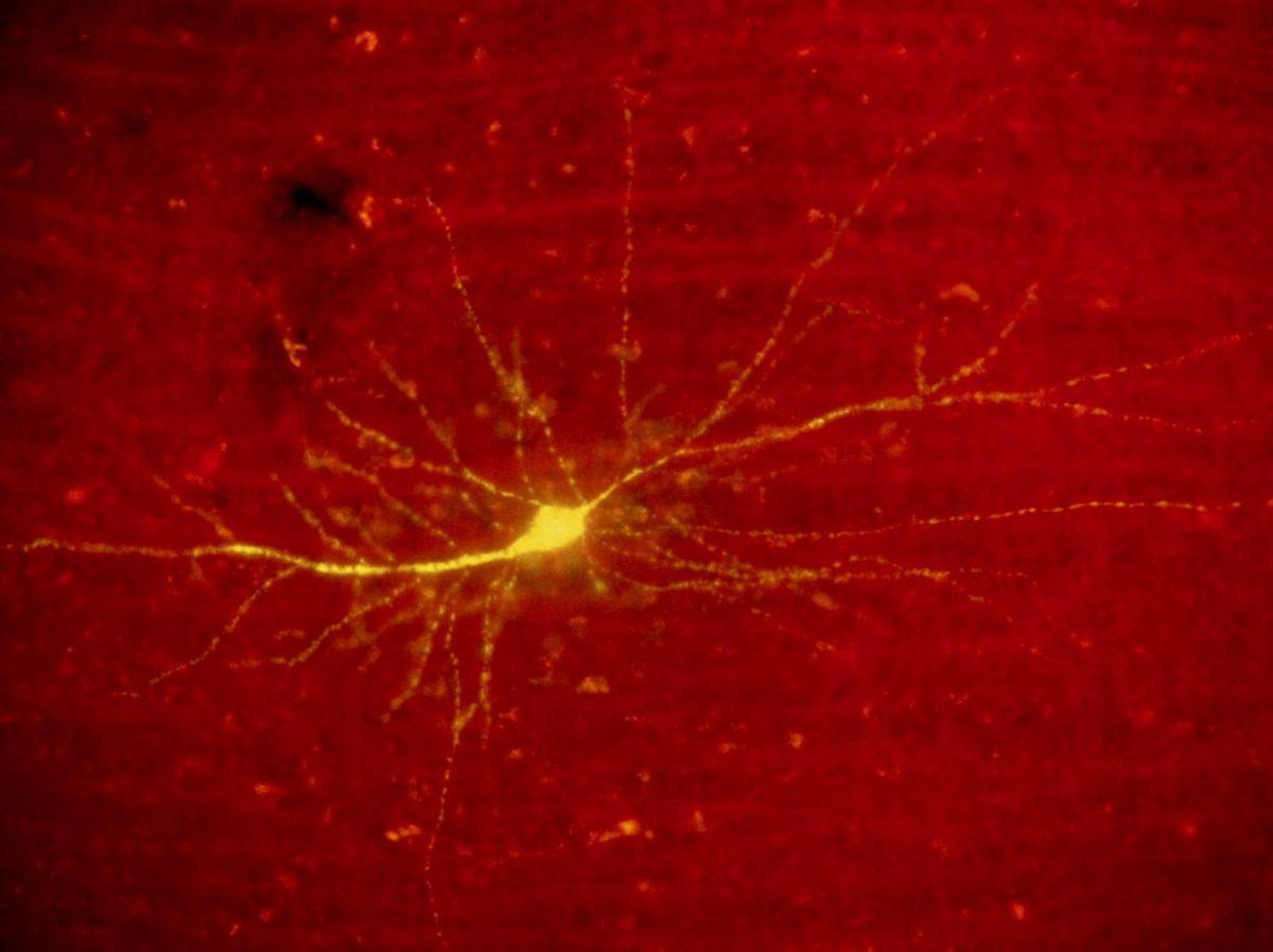 Un Interrupteur Épigénétique pour les Souvenirs Un Interrupteur Épigénétique pour les Souvenirs