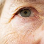 Le Vieillissement se Voit dans les Yeux Le Vieillissement se Voit dans les Yeux