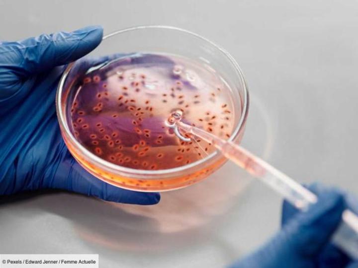 Un vaccin antivariolique existant approuvé pour lutter contre la variole du singe Un vaccin antivariolique existant approuvé pour lutter contre la variole du singe