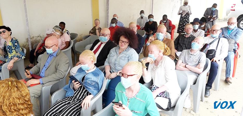 pourquoi les albinos sont contraints au port des lunettes ?