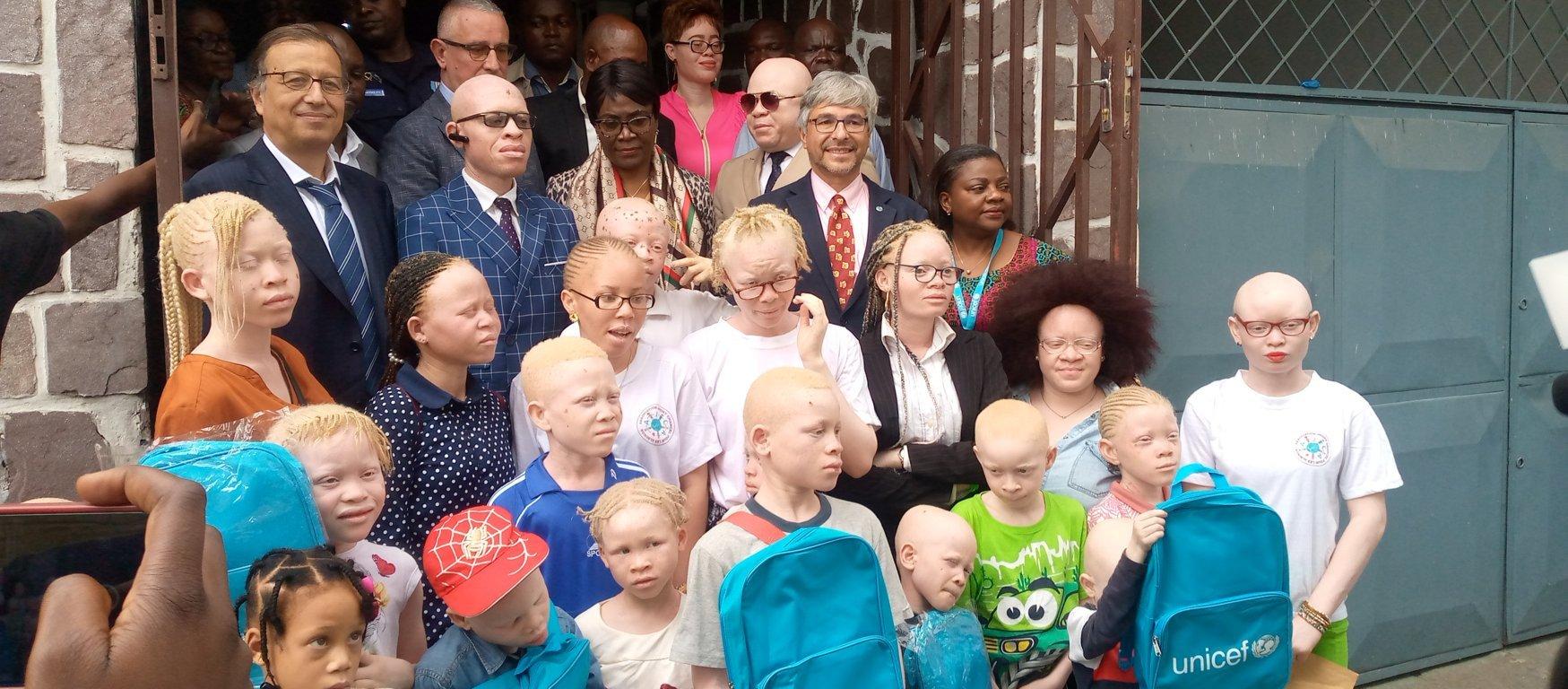 Actions sociales : remise des fournitures scolaires aux élèves albinos Actions sociales : remise des fournitures scolaires aux élèves albinos