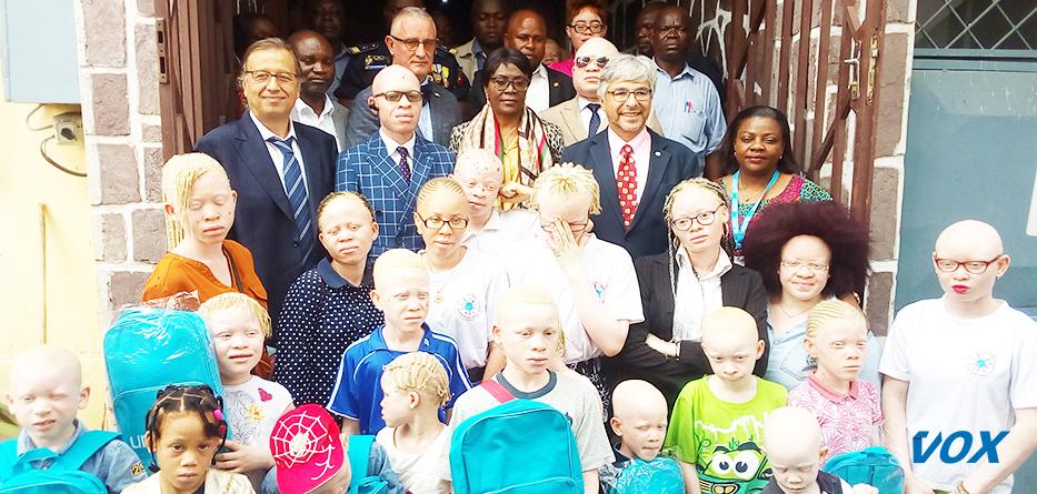 des élèves albinois reçoivent des kits scolaires et lunettes de lecture des élèves albinois reçoivent des kits scolaires et lunettes de lecture