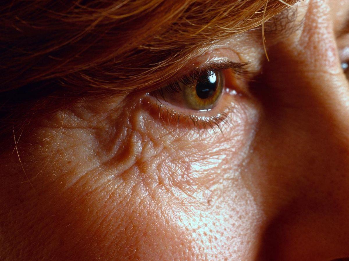 Un nouvel effet inattendu de la pollution de l'air : le vieillissement des yeux Un nouvel effet inattendu de la pollution de l'air : le vieillissement des yeux