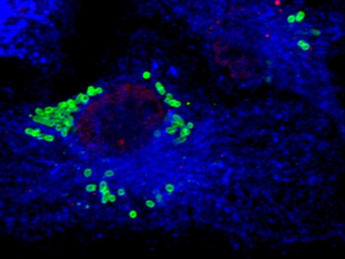 Infection : le rôle insoupçonné des cellules souches du sang dans la réponse immunitaire Infection : le rôle insoupçonné des cellules souches du sang dans la réponse immunitaire