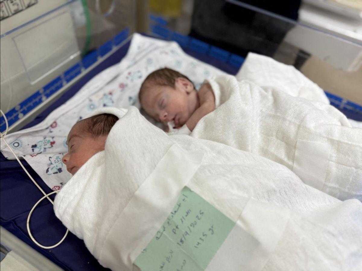 Malnutrition à Gaza Aura Des Effets Générationnels Malnutrition à Gaza Aura Des Effets Générationnels