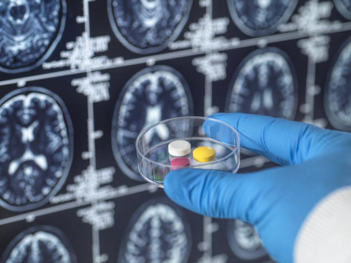 Lithium, Clé Pour Traiter La Maladie D'Alzheimer Lithium, Clé Pour Traiter La Maladie D'Alzheimer