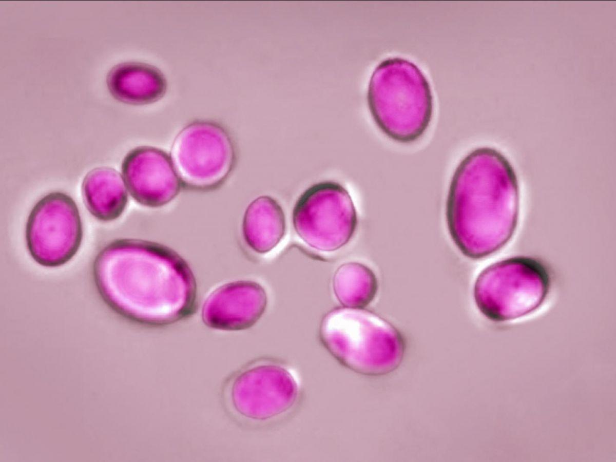 Champignon Multirésistant Alerte les Hôpitaux Européens Champignon Multirésistant Alerte les Hôpitaux Européens