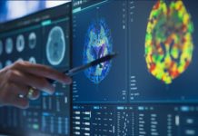 Sport Adoré Lié à un Risque Accru d’Alzheimer Sport Adoré Lié à un Risque Accru d'Alzheimer