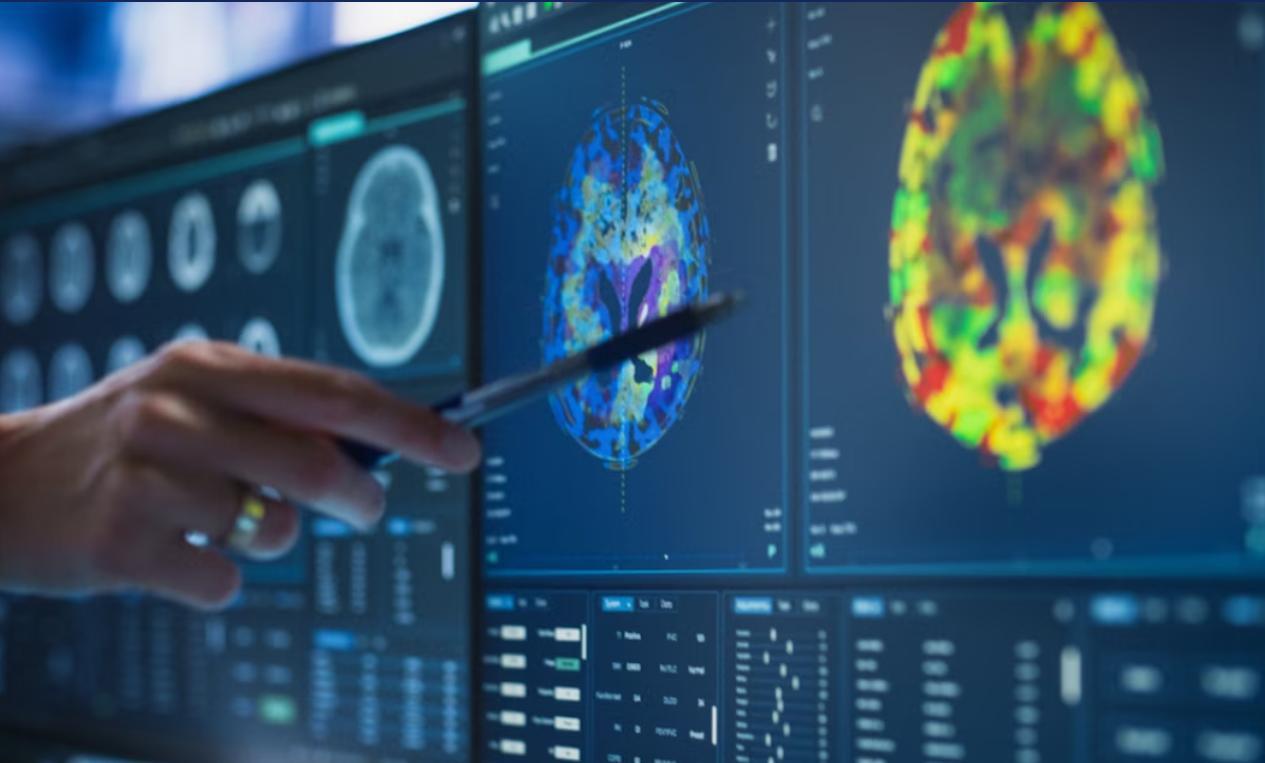 Sport Adoré Lié à un Risque Accru d'Alzheimer Sport Adoré Lié à un Risque Accru d'Alzheimer