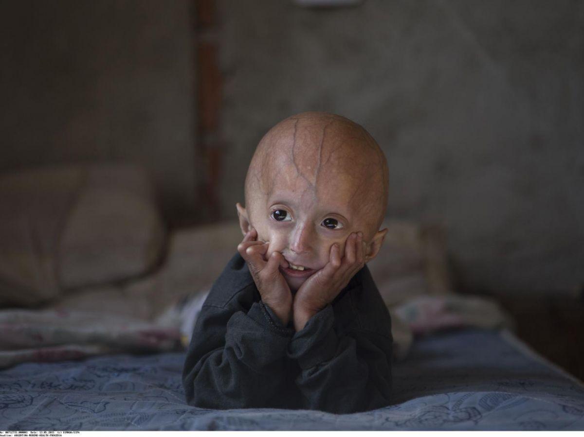 Les Gènes Des Centenaires Contre Le Vieillissement Les Gènes Des Centenaires Contre Le Vieillissement