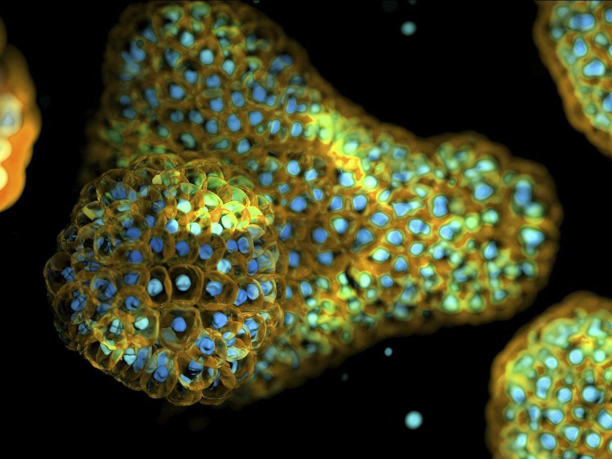 Maladies Respiratoires Et Organoïdes Pulmonaires Maladies Respiratoires Et Organoïdes Pulmonaires
