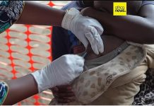 Rougeole Aggrave Crise Humanitaire à Masisi Rougeole Aggrave Crise Humanitaire à Masisi