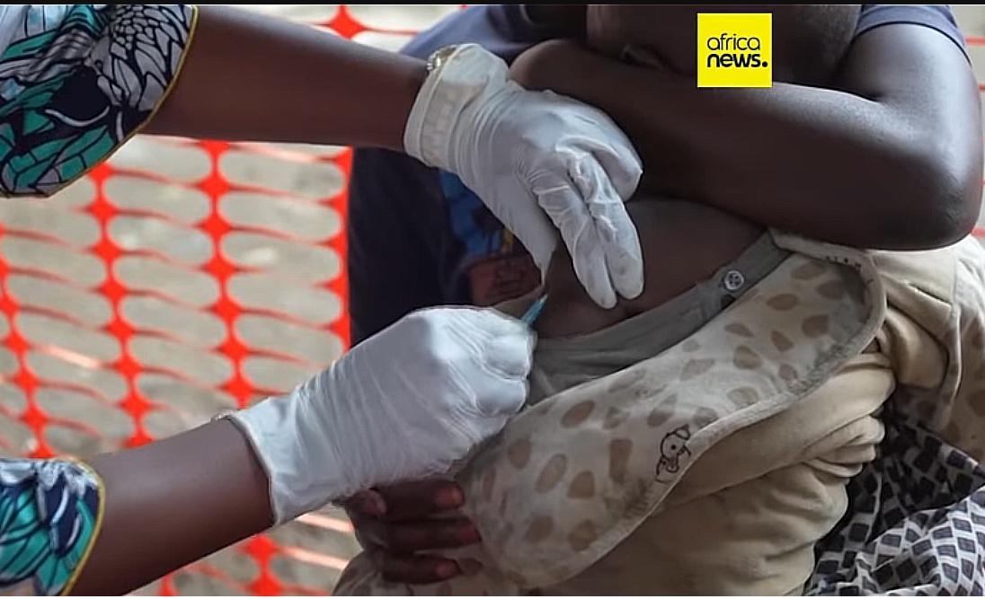 Rougeole Aggrave Crise Humanitaire à Masisi Rougeole Aggrave Crise Humanitaire à Masisi