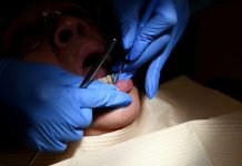 Caries Dentaires Vers Le Remboursement De Quatre Traitements Caries Dentaires Vers Le Remboursement De Quatre Traitements