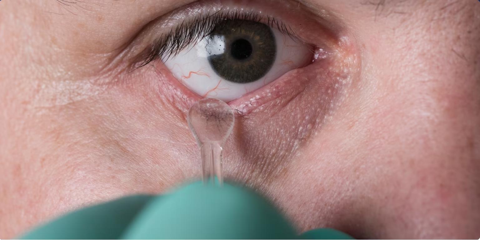 Patient Retrouve La Vue Grâce À Une Greffe Inattendue Patient Retrouve La Vue Grâce À Une Greffe Inattendue