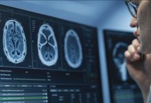 IRM Cérébrale: IA Améliore Détection des Anomalies IRM Cérébrale: IA Améliore Détection des Anomalies