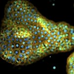 Maladies Respiratoires Et Organoïdes Pulmonaires Maladies Respiratoires Et Organoïdes Pulmonaires