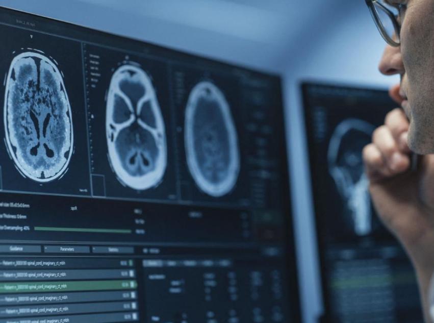 IRM Cérébrale: IA Améliore Détection des Anomalies IRM Cérébrale: IA Améliore Détection des Anomalies