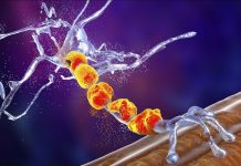 Maladie de Charcot et Origine des Protéines Toxiques Maladie de Charcot et Origine des Protéines Toxiques