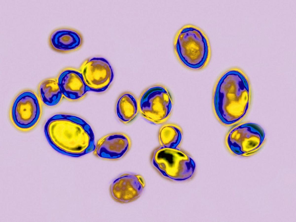 Faut-il s'inquiéter de Candida auris, le champignon résistant qui se répand aux Etats-Unis ? Faut-il s'inquiéter de Candida auris, le champignon résistant qui se répand aux Etats-Unis ?