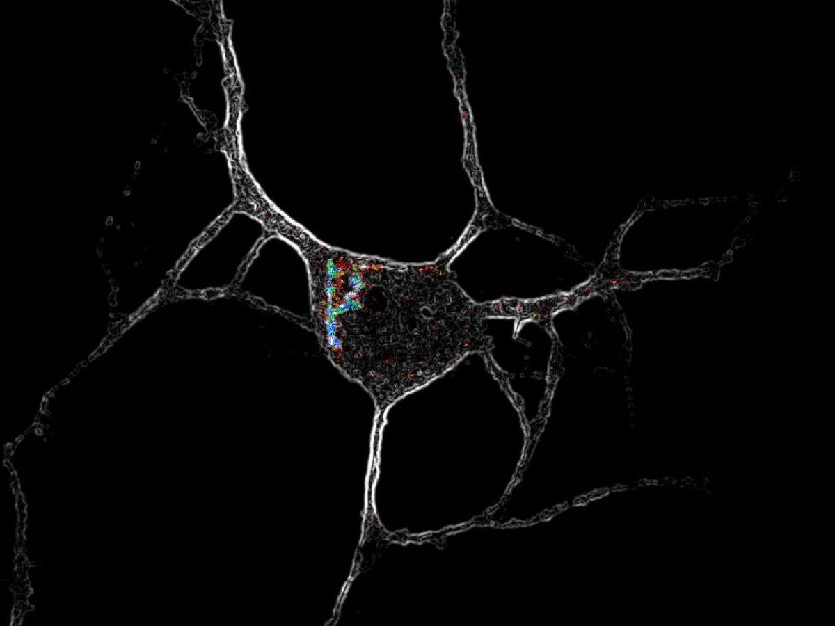 Comment les drogues psychédéliques remodèlent le cerveau Comment les drogues psychédéliques remodèlent le cerveau