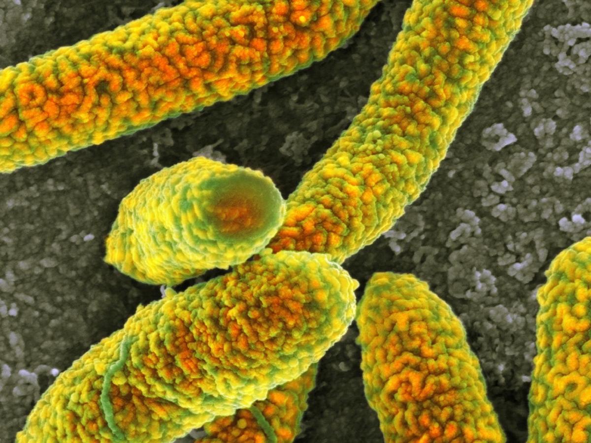 Qu'est-ce que la bactérie Escherichia coli et quelles maladies provoque-t-elle ?