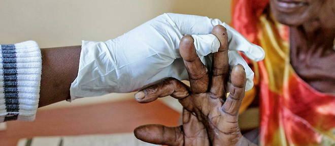 Comment le changement climatique propage le paludisme en Afrique