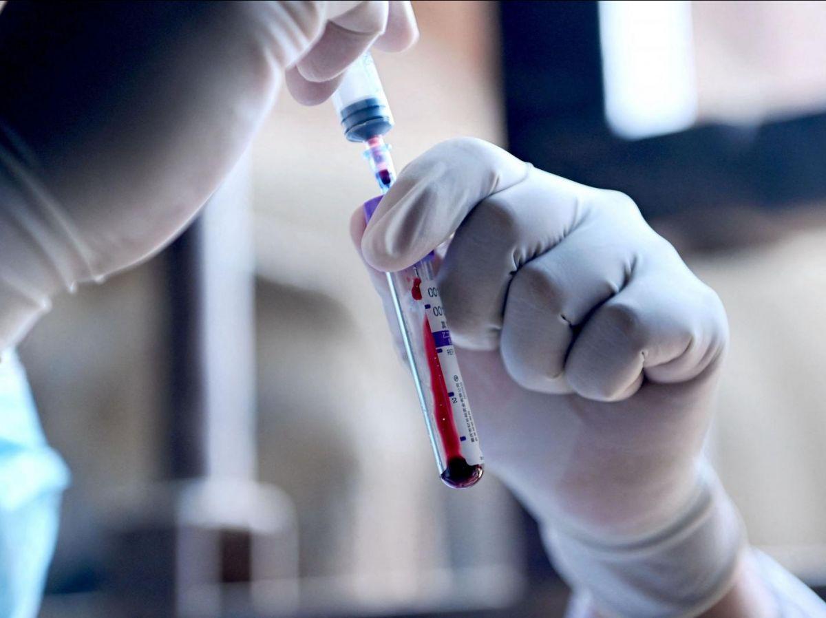 Ferritine élevée : quelles sont les causes ? Ferritine élevée : quelles sont les causes ?